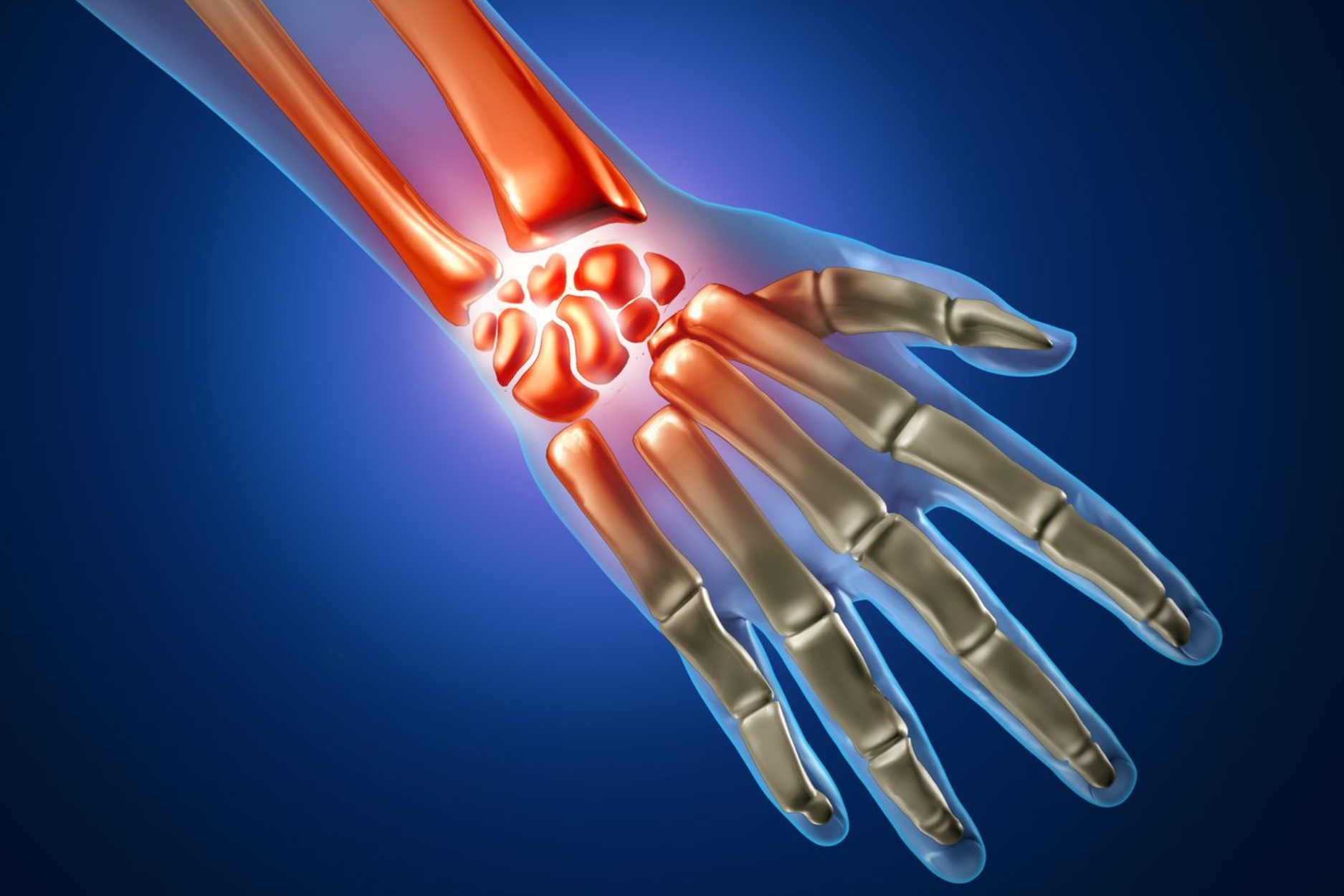 Hand surgery by Dr. Jagdish Pusa — tendon repair, carpal tunnel, tennis elbow, contractures, and hand fractures in Uppal, Hyderabad